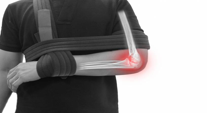 Condemnen Honeywell per infraccions que van causar epicondilitis a un treballador