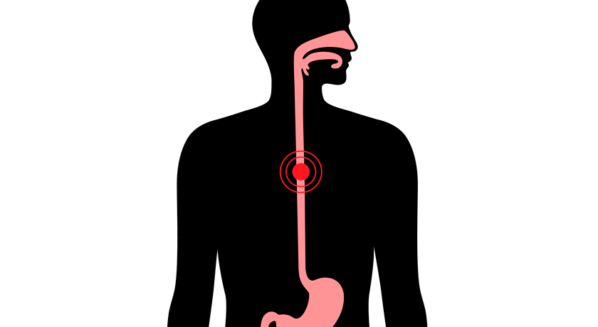 Anàlisi de la sentència: treballador exposat a l’amiant mor per càncer&nbsp;d’esòfag